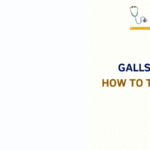 Gallstones vs Gas Pain