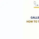Gallstones vs Gas Pain
