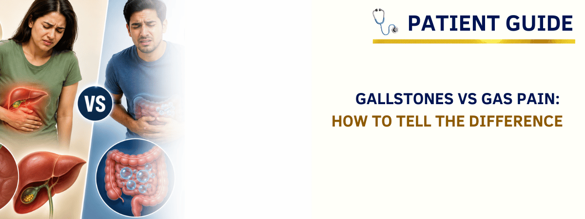 Gallstones vs Gas Pain