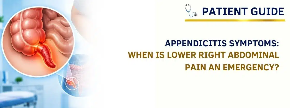 Appendicitis symptoms and lower right abdominal pain