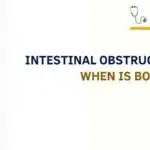 intestinal obstruction symptoms and bowel blockage illustration