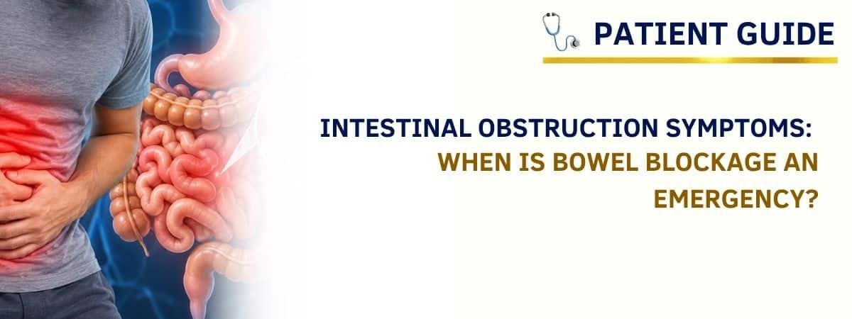 intestinal obstruction symptoms and bowel blockage illustration