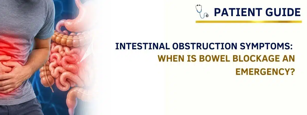 intestinal obstruction symptoms and bowel blockage illustration